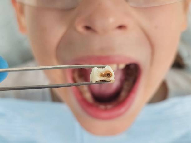 Best Urgent Tooth Repair  in Cementon, PA